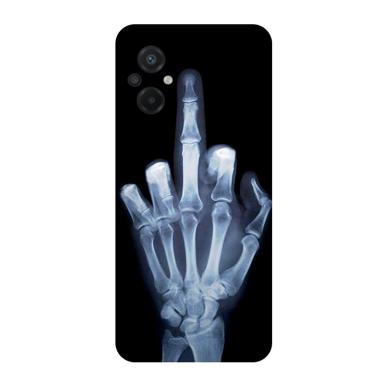 Per Poco M5 2022 custodia 4G c - Phone Cases Liverpool recensione e prezzo